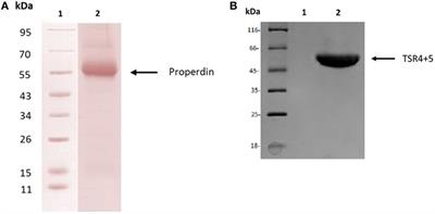 Human Properdin Modulates Macrophage: Mycobacterium bovis BCG Interaction via Thrombospondin Repeats 4 and 5